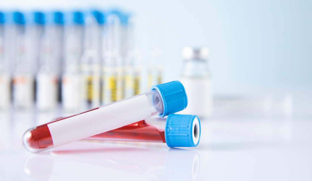 New Liquid Biopsy Technique May Help Personalize Breast Cancer Diagnosis and Prognosis